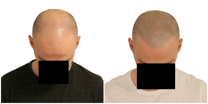 index.php/fa/37600/0/