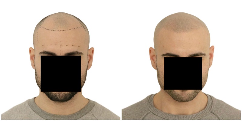 index.php/fa/37647/0/