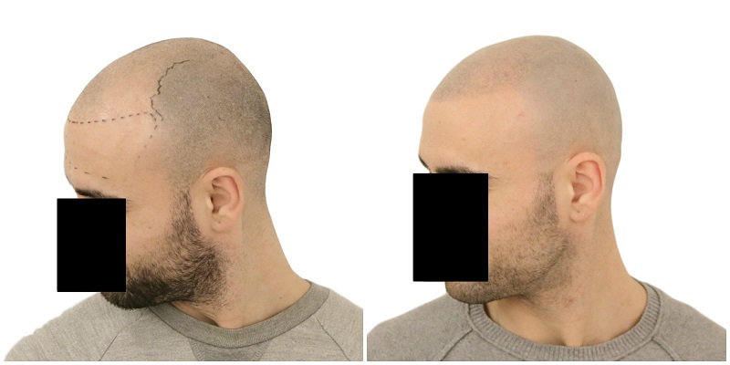 index.php/fa/37649/0/