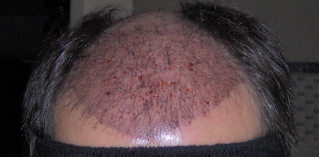 index.php/fa/3770/0/