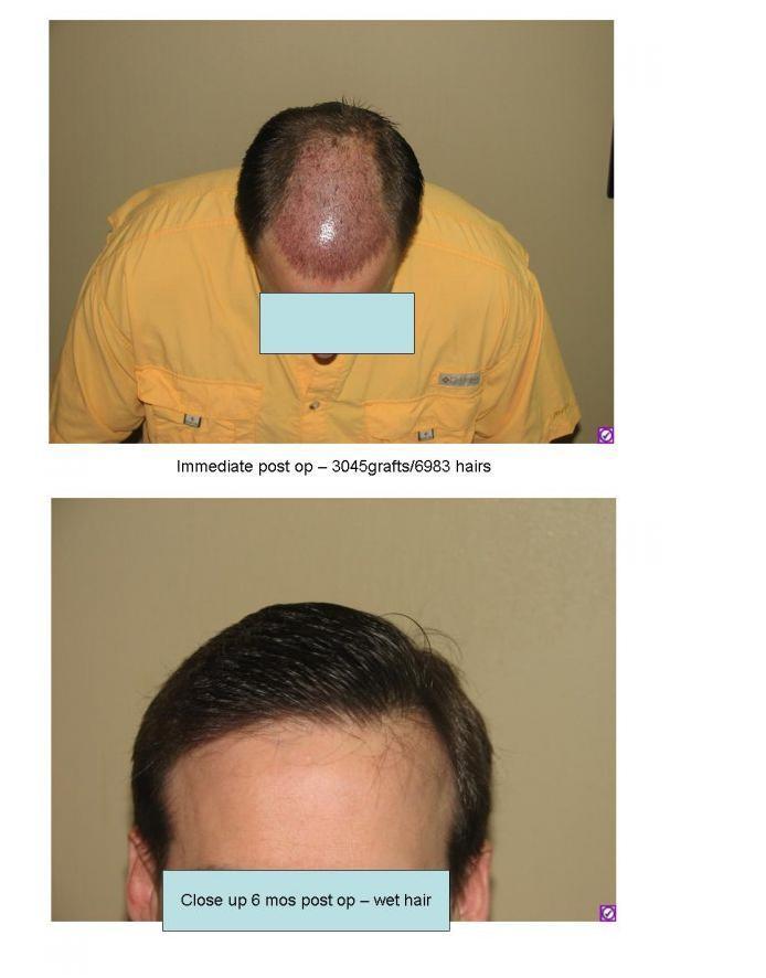 index.php/fa/3779/0/