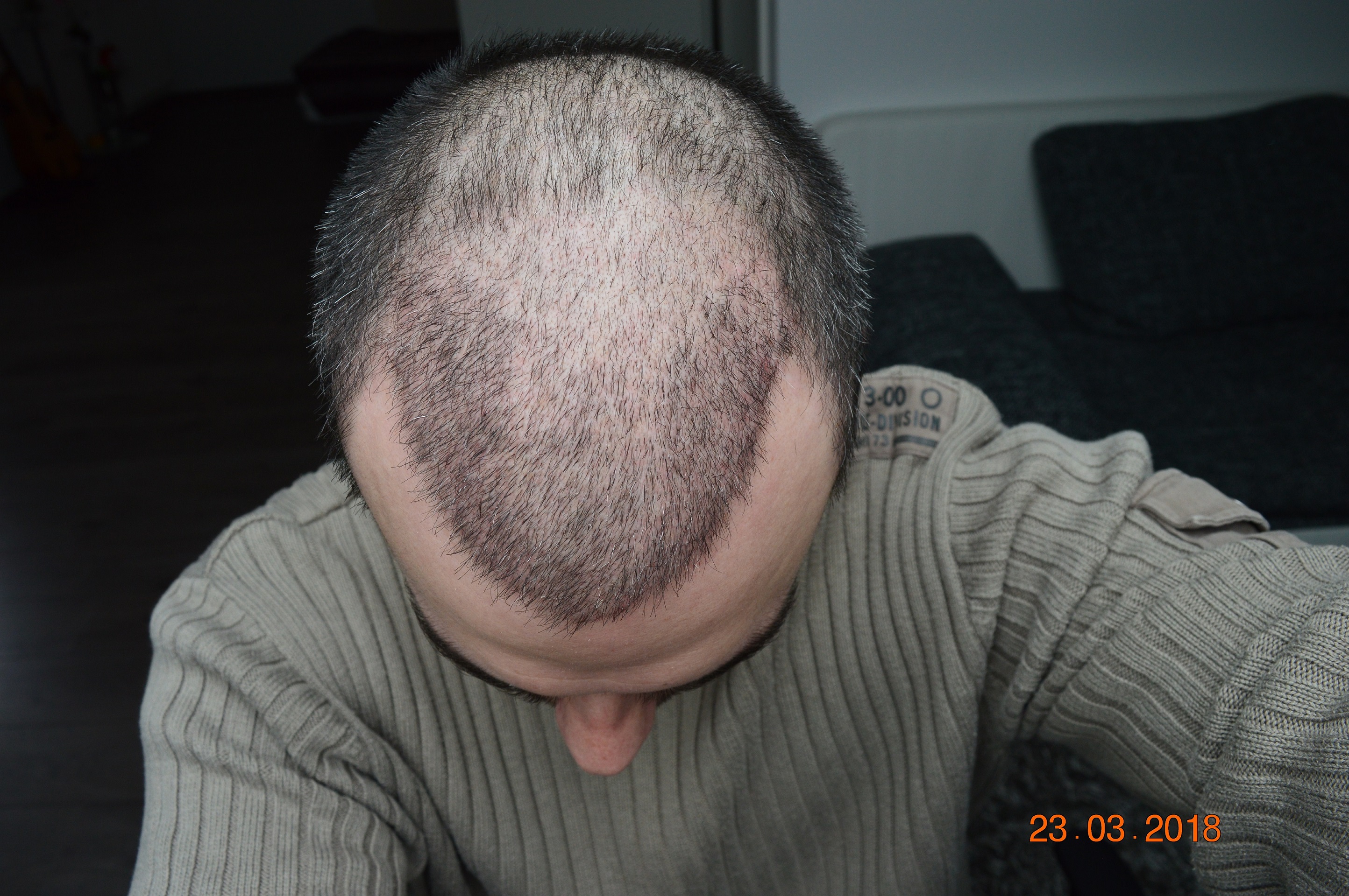 index.php/fa/37801/0/