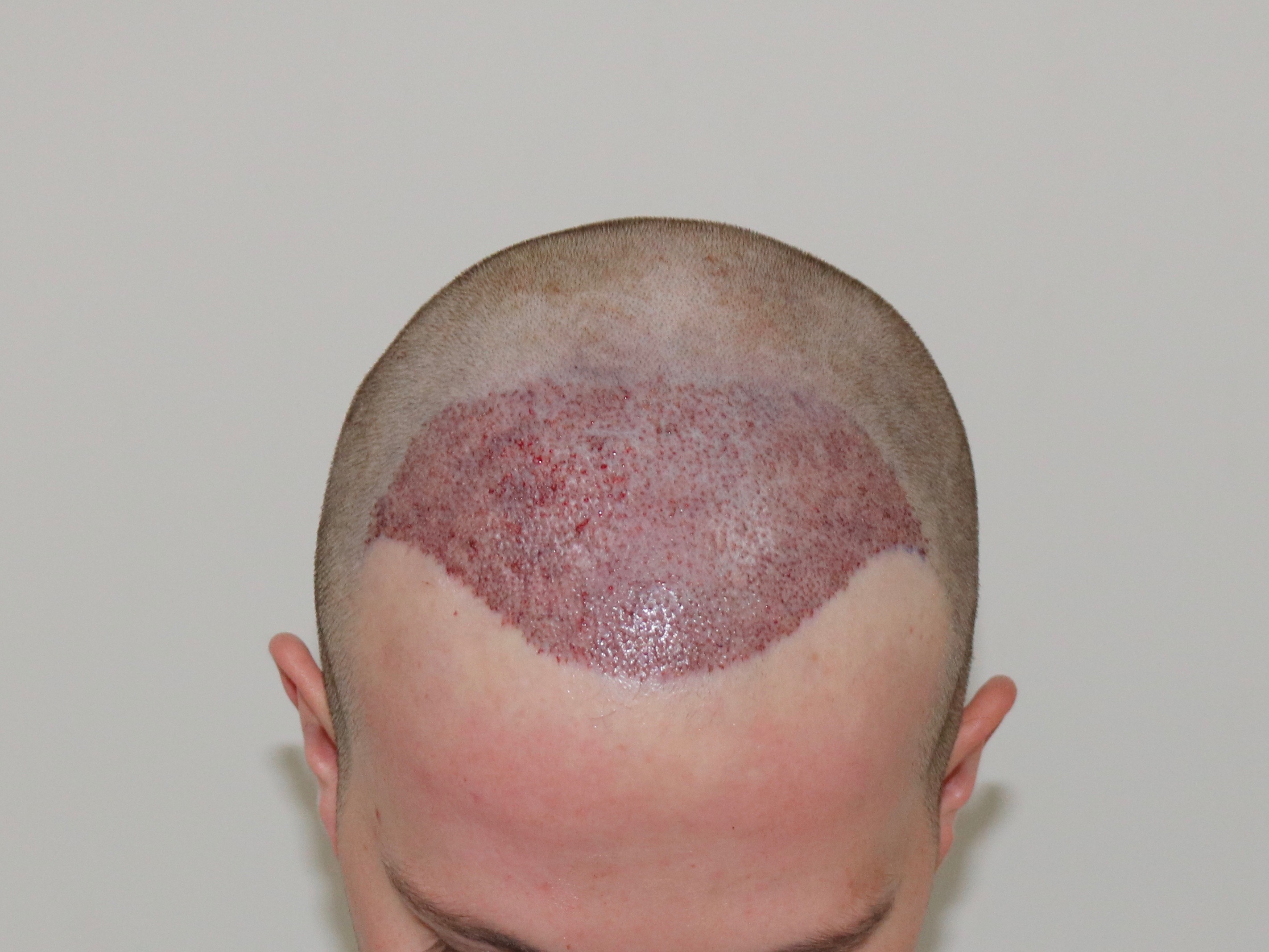 index.php/fa/37901/0/