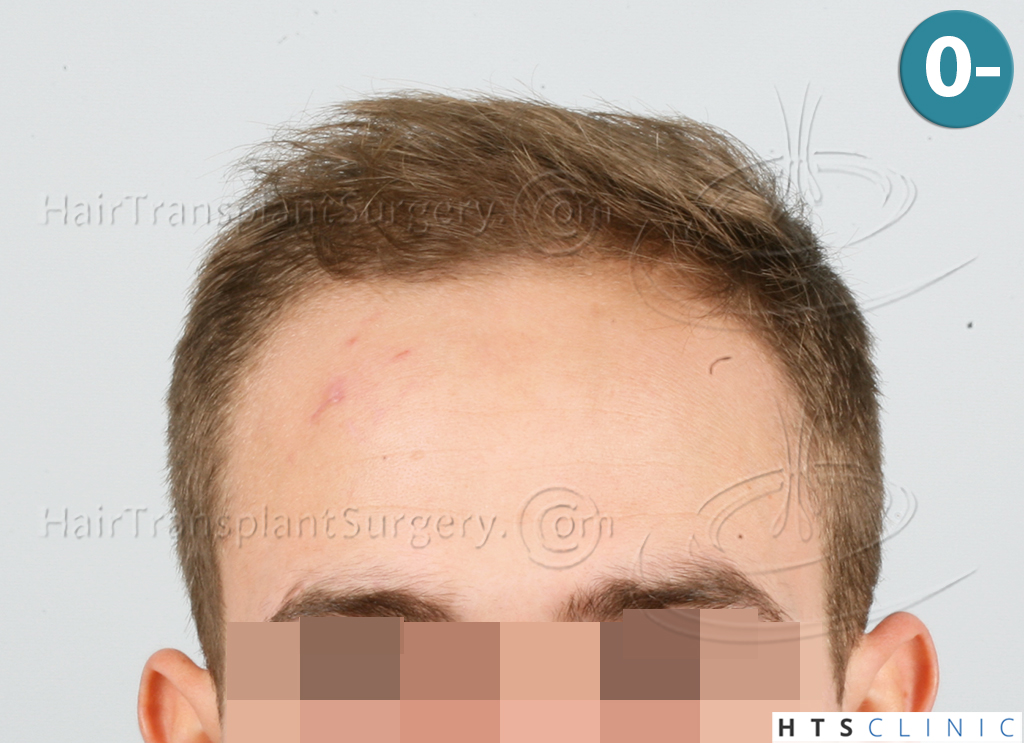 index.php/fa/37944/0/