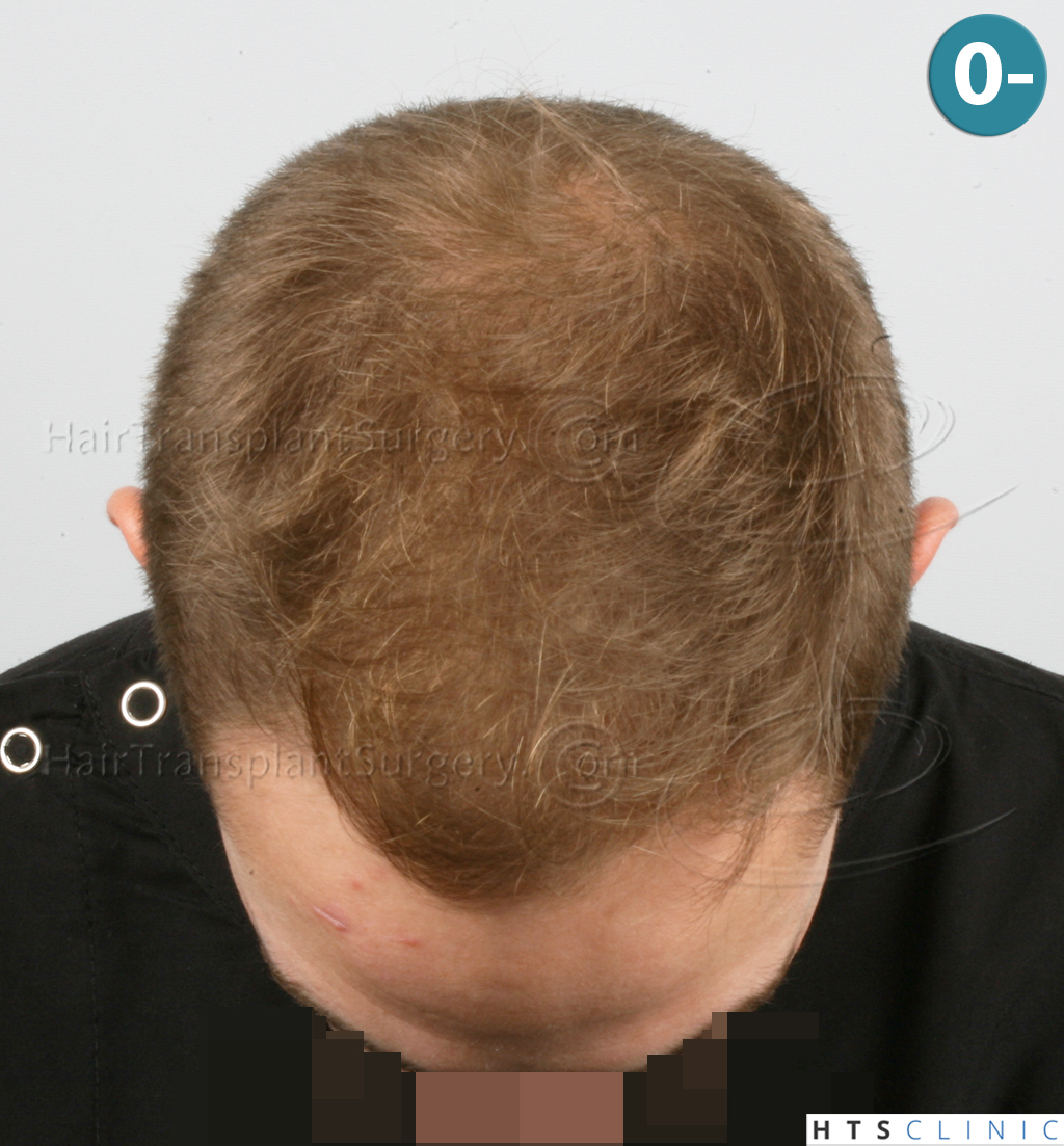 index.php/fa/37945/0/