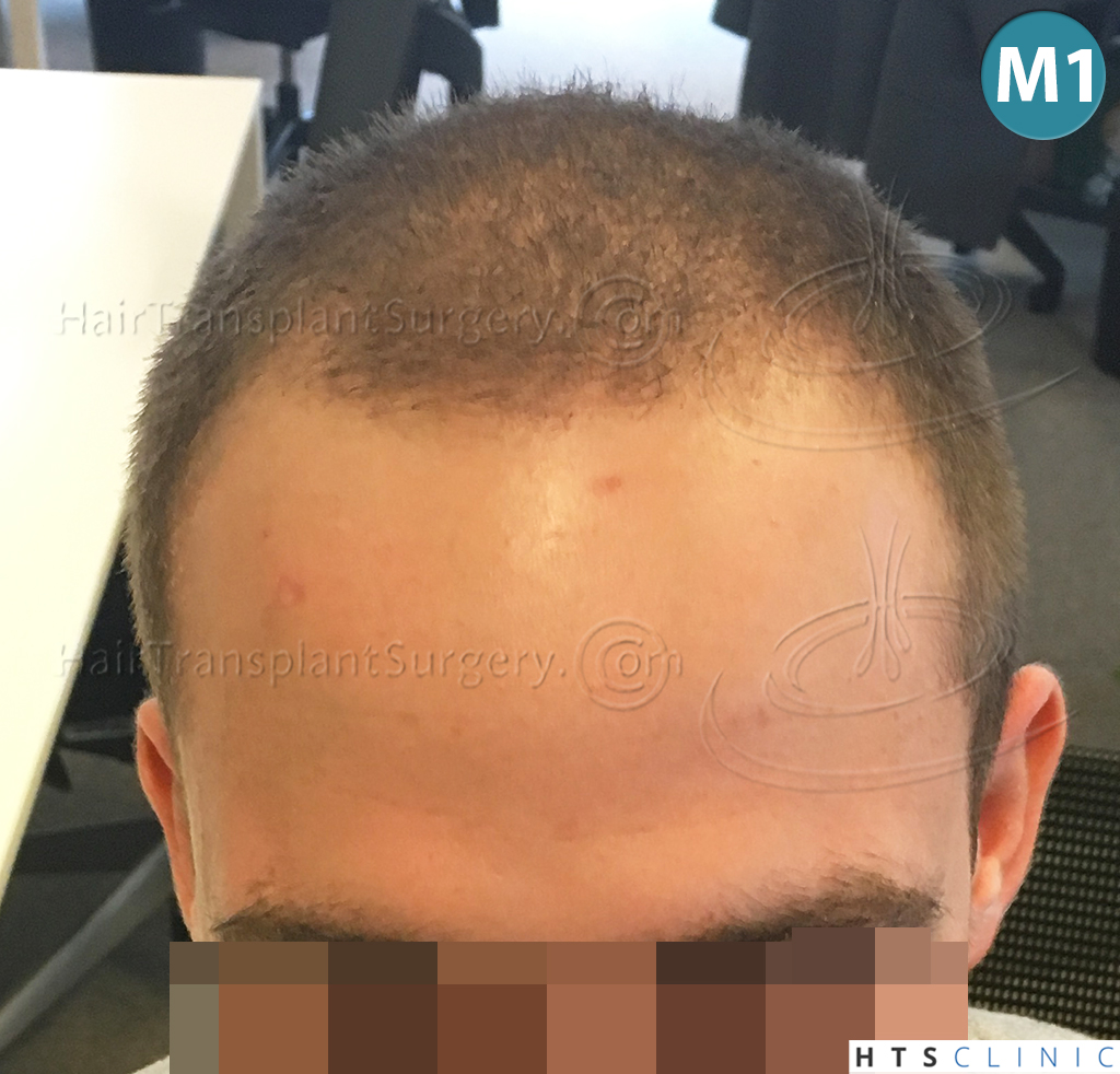 index.php/fa/37949/0/