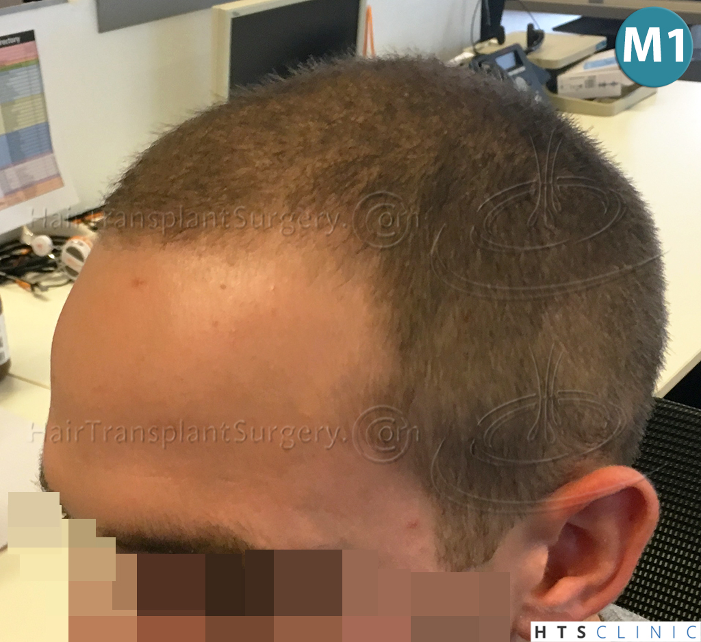 index.php/fa/37951/0/