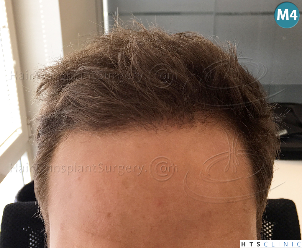 index.php/fa/37952/0/