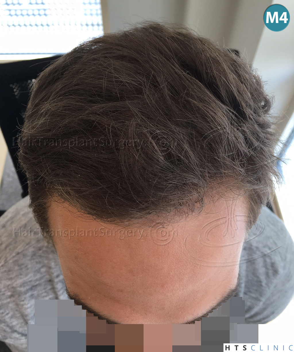 index.php/fa/37953/0/