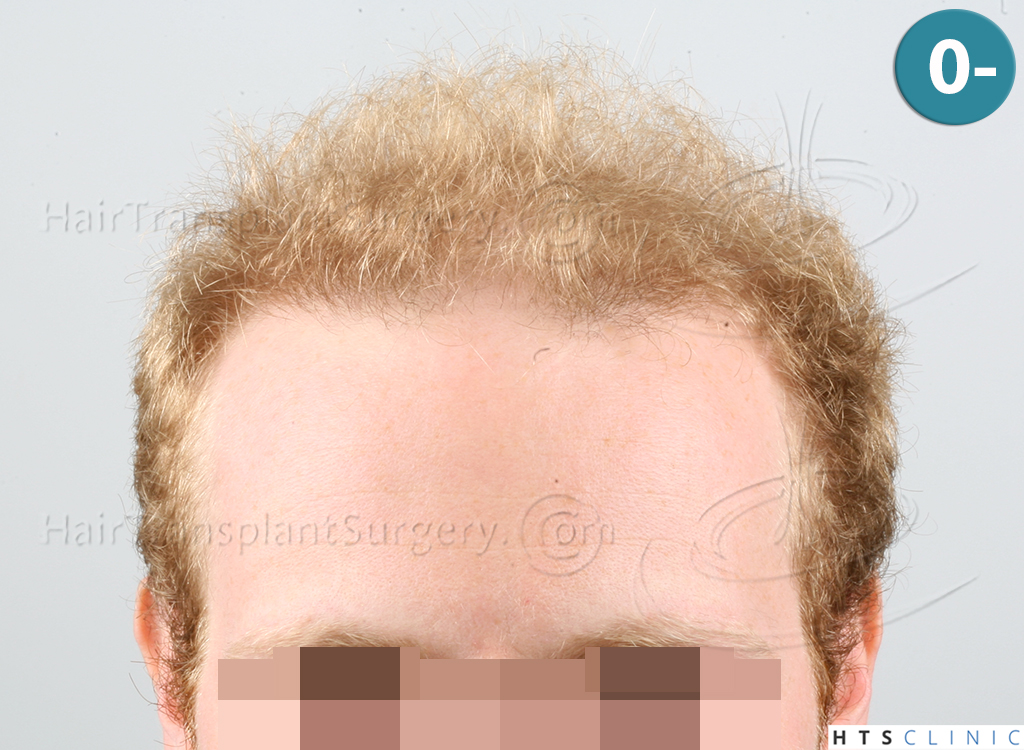 index.php/fa/38001/0/