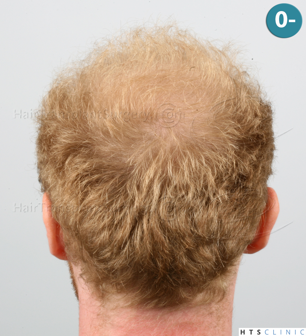 index.php/fa/38003/0/