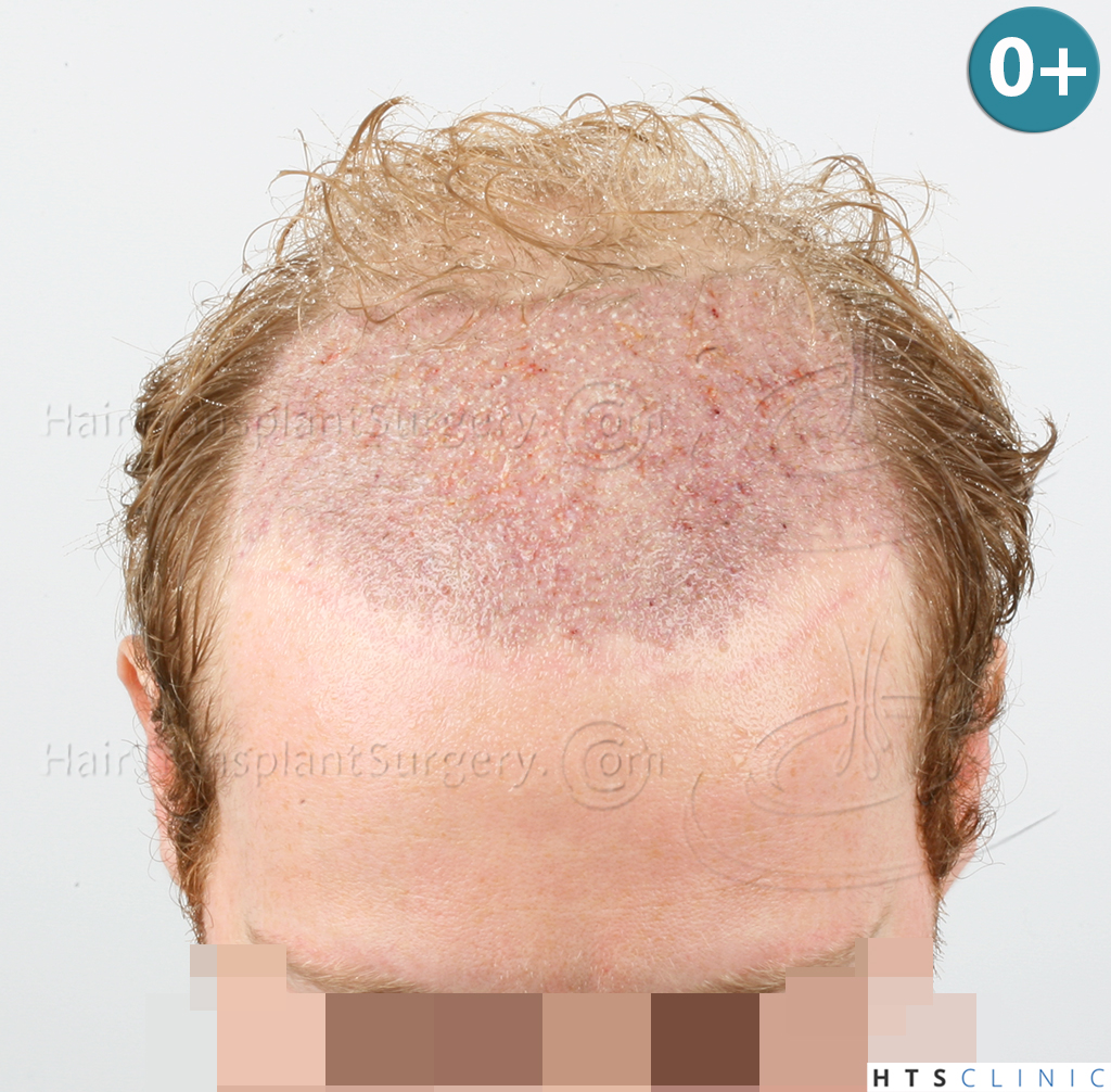 index.php/fa/38004/0/