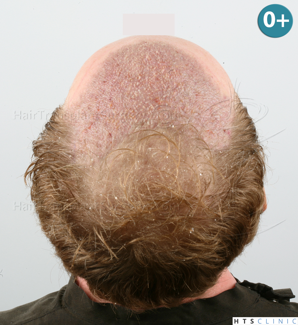 index.php/fa/38005/0/