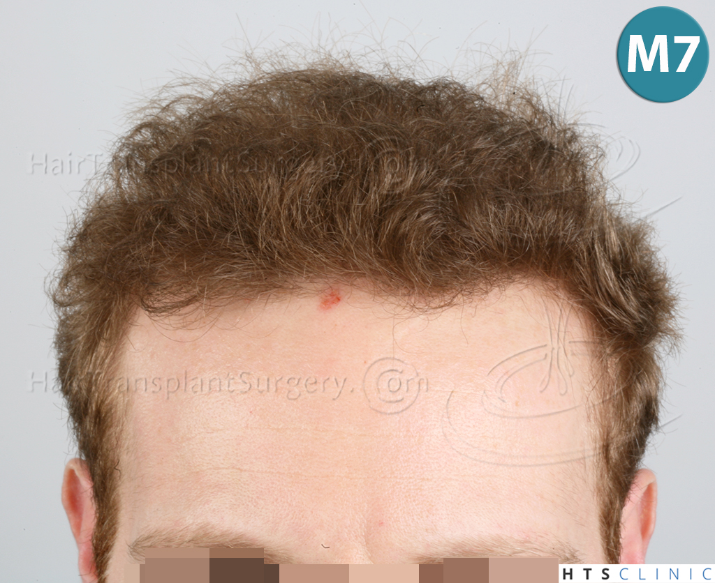 index.php/fa/38006/0/