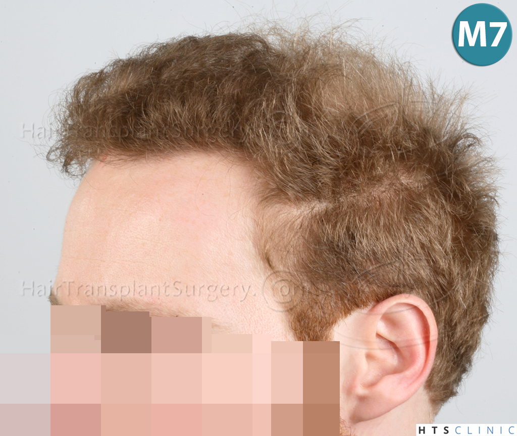 index.php/fa/38007/0/