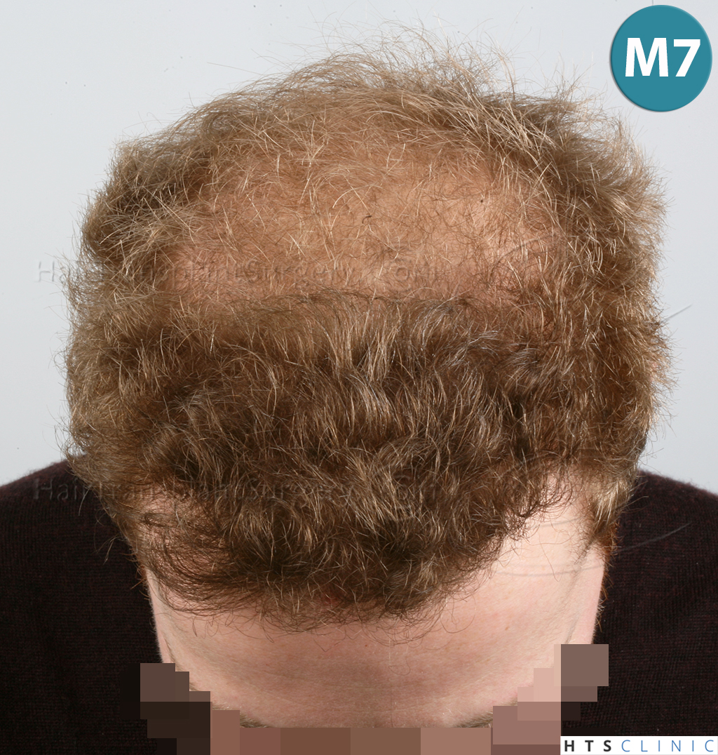 index.php/fa/38039/0/