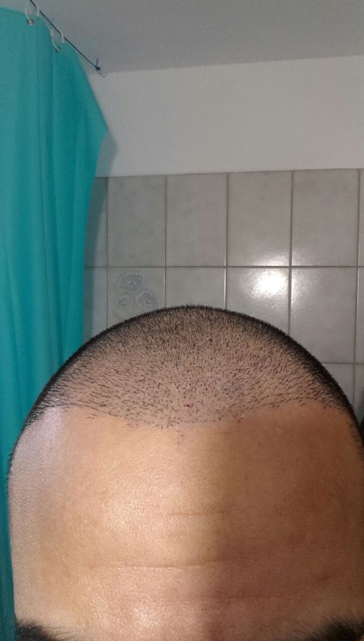 index.php/fa/38083/0/