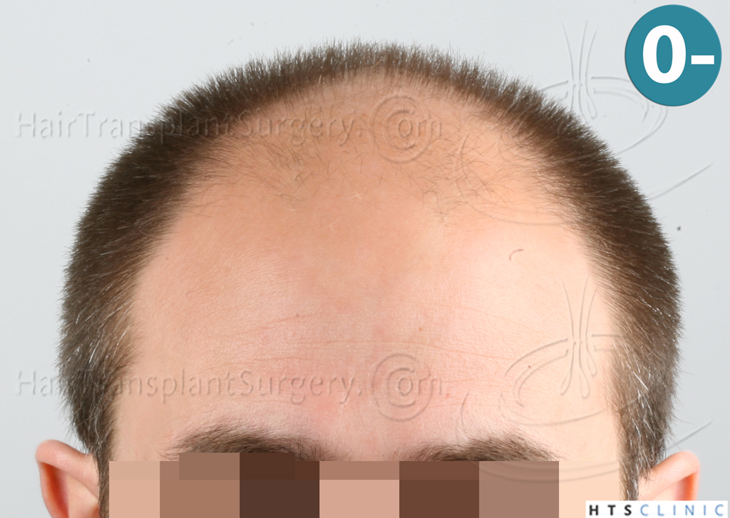 index.php/fa/38086/0/