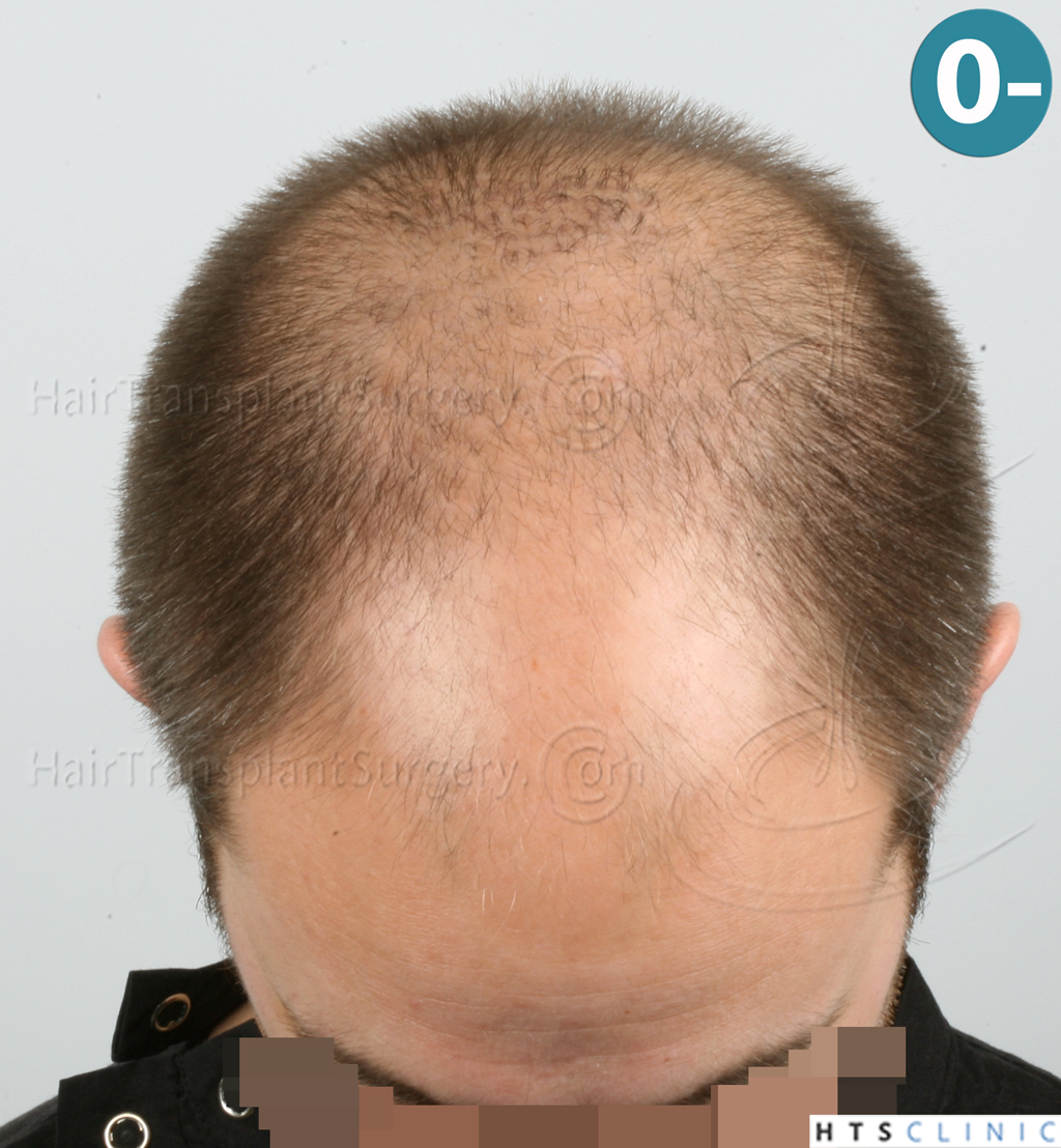 index.php/fa/38087/0/