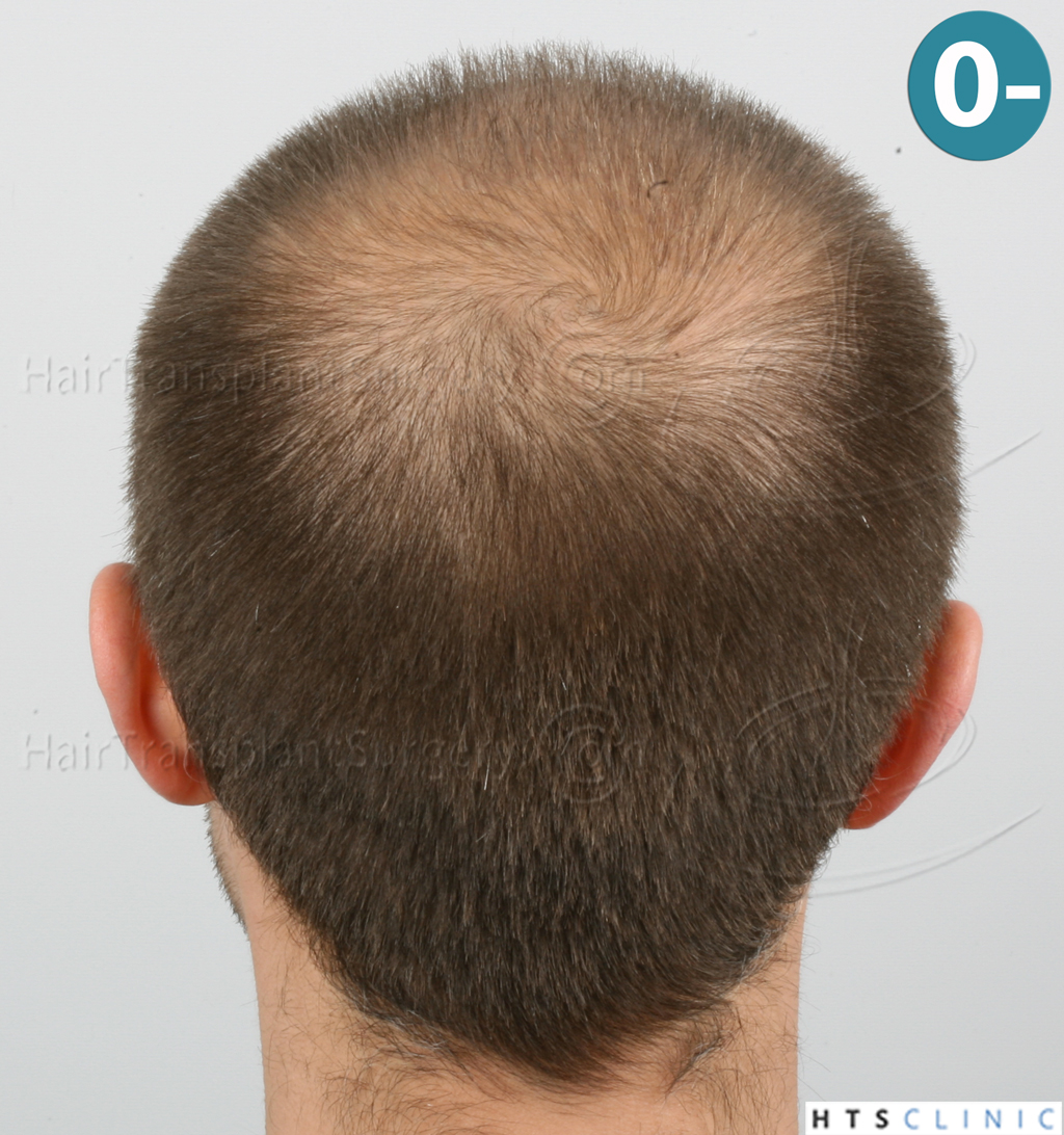 index.php/fa/38089/0/