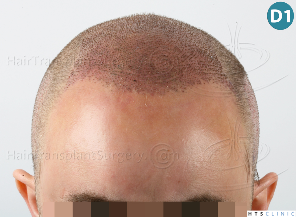 index.php/fa/38090/0/