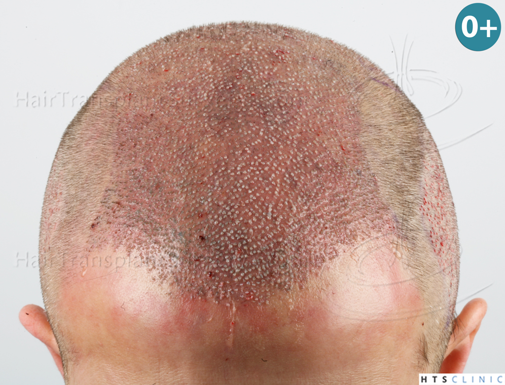 index.php/fa/38091/0/