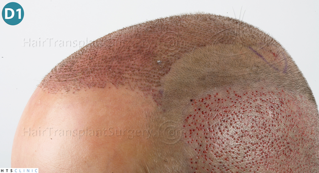 index.php/fa/38092/0/