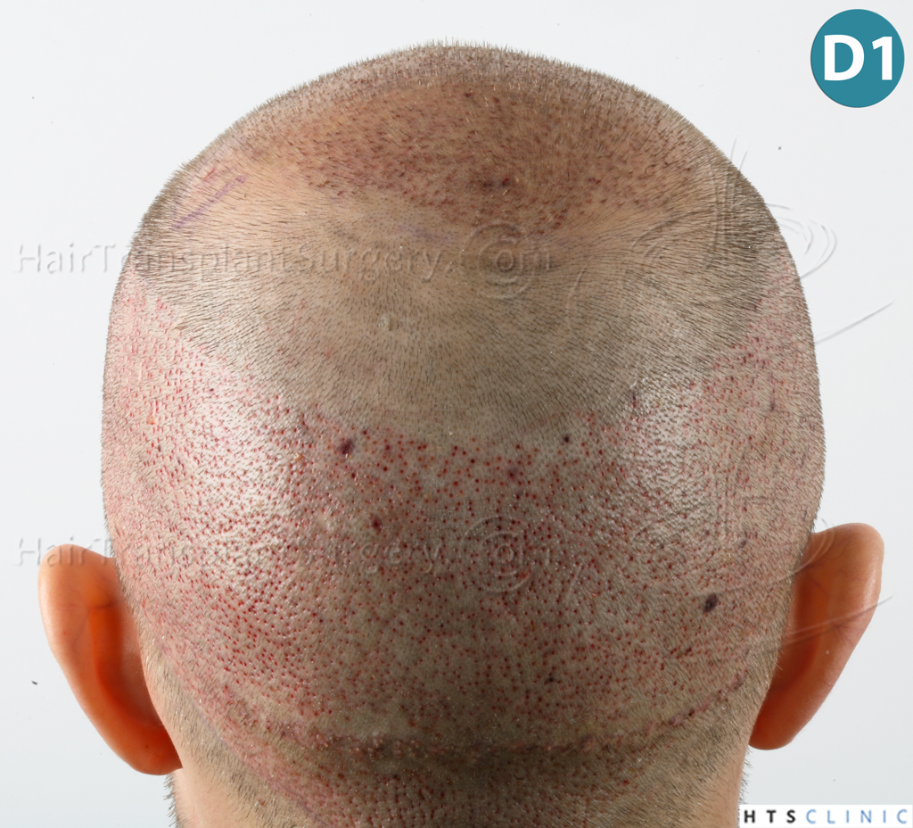 index.php/fa/38094/0/