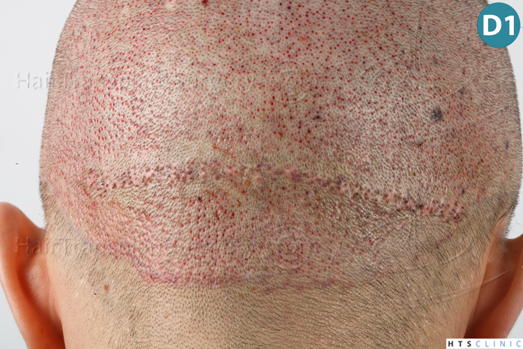 index.php/fa/38095/0/