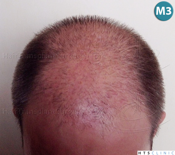 index.php/fa/38096/0/