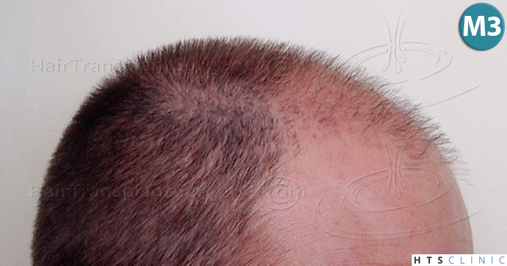 index.php/fa/38097/0/