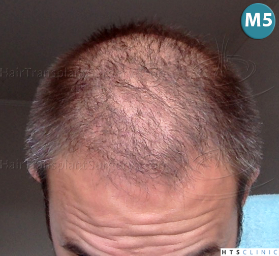 index.php/fa/38098/0/