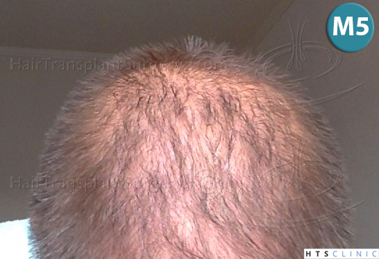 index.php/fa/38099/0/