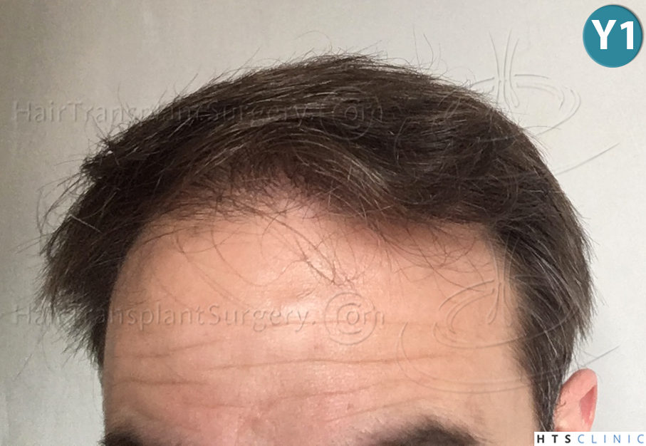 index.php/fa/38102/0/