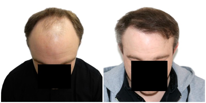 index.php/fa/38114/0/