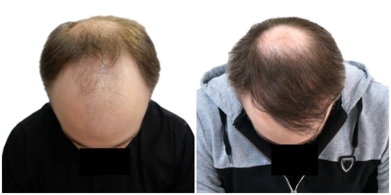 index.php/fa/38115/0/