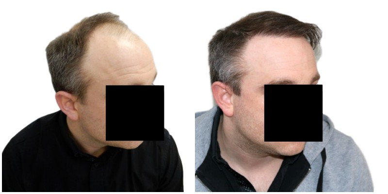 index.php/fa/38116/0/