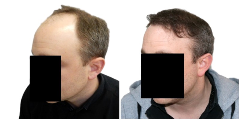 index.php/fa/38117/0/