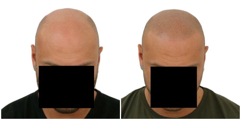 index.php/fa/38171/0/