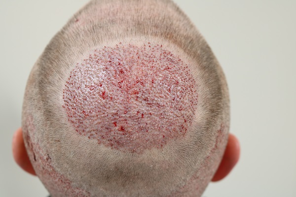 index.php/fa/38239/0/