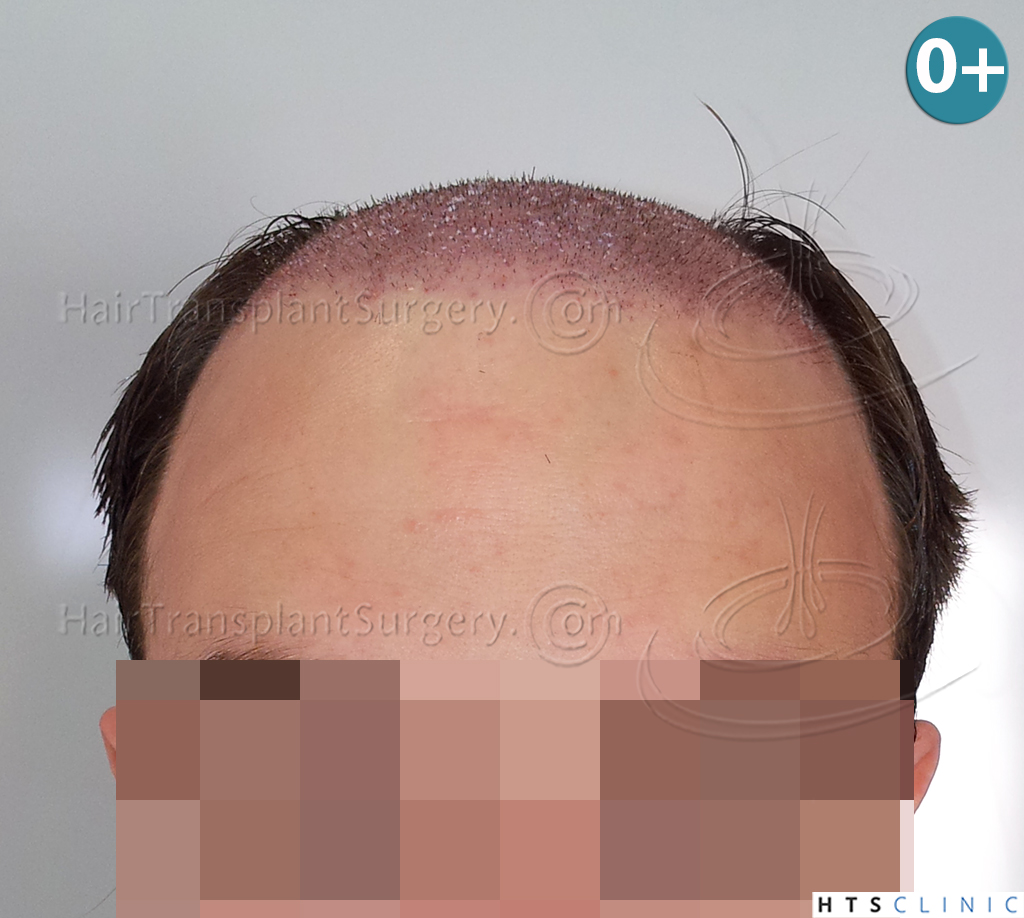 index.php/fa/38289/0/