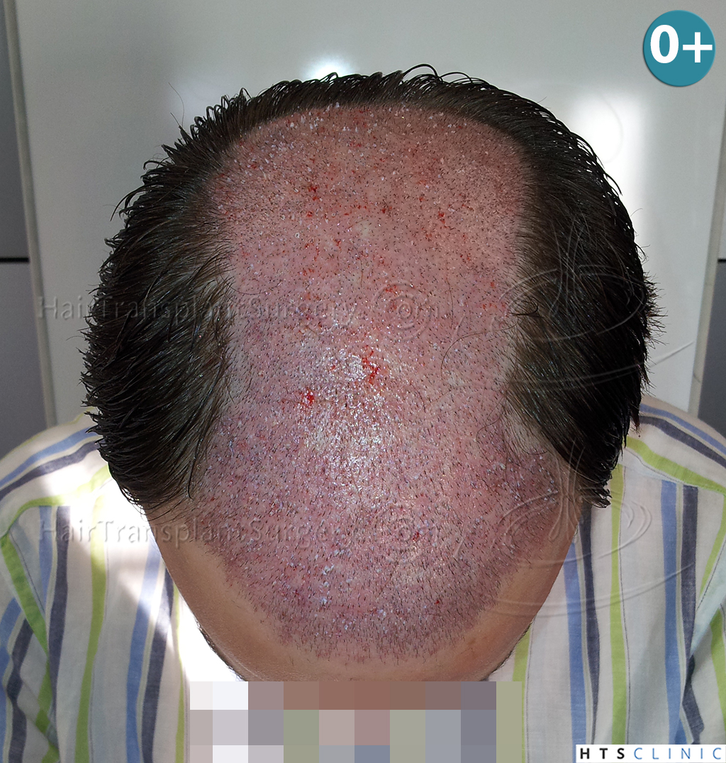 index.php/fa/38290/0/