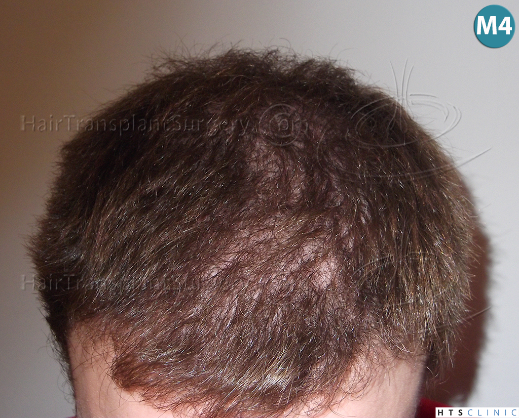 index.php/fa/38291/0/