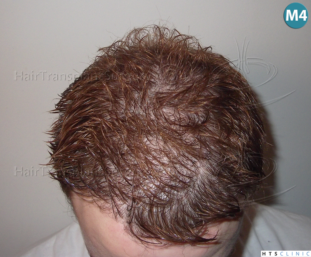 index.php/fa/38292/0/