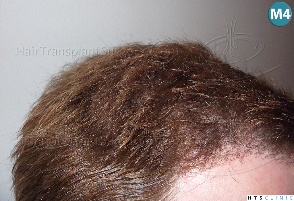 index.php/fa/38293/0/