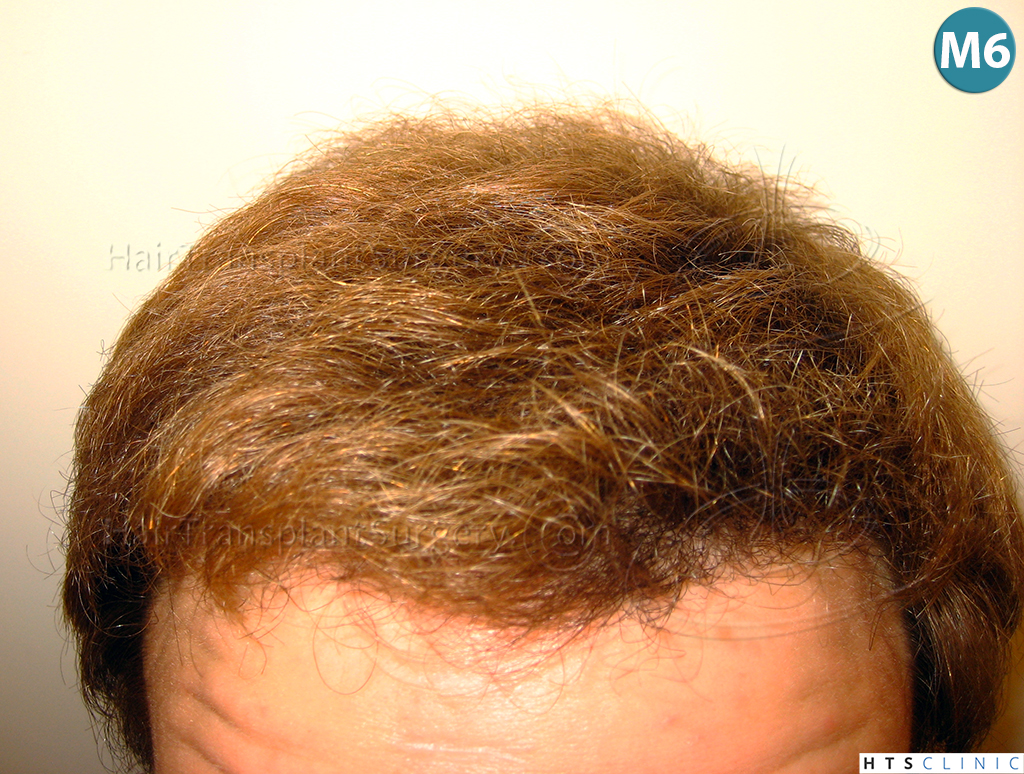 index.php/fa/38294/0/