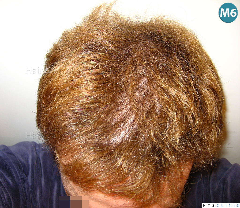 index.php/fa/38296/0/