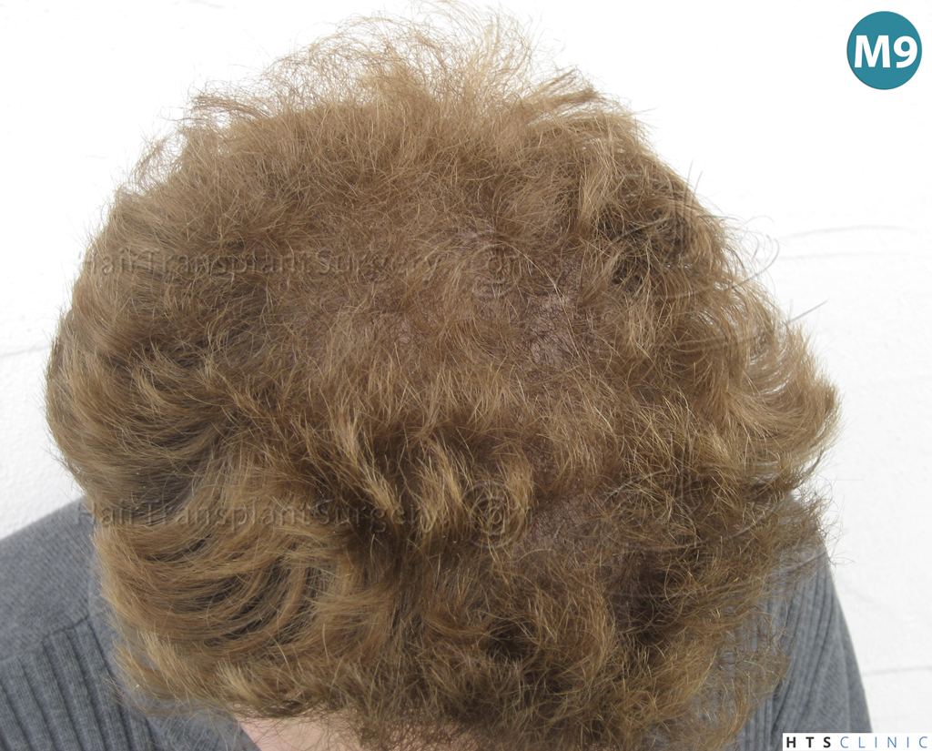 index.php/fa/38301/0/