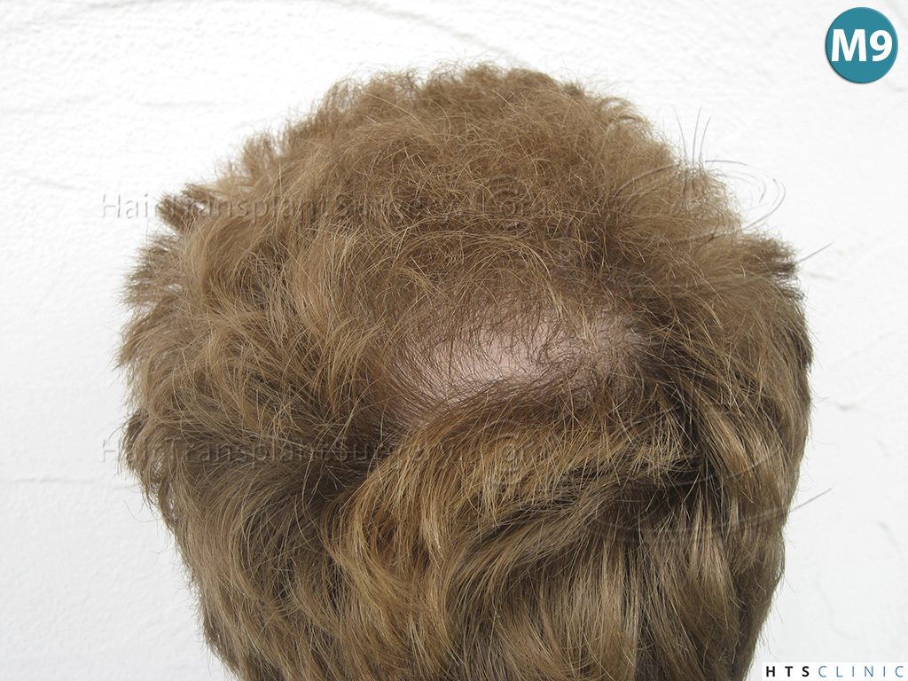 index.php/fa/38303/0/