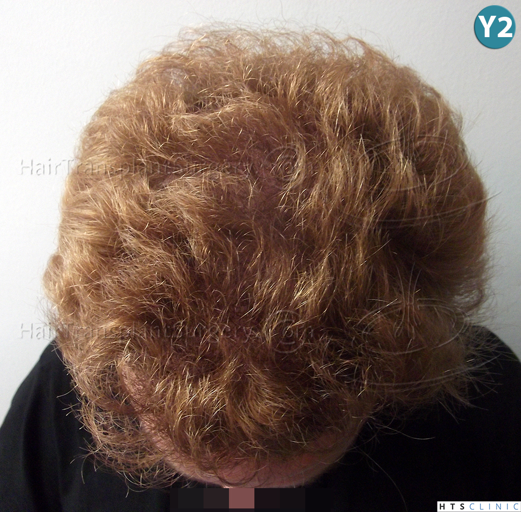 index.php/fa/38305/0/